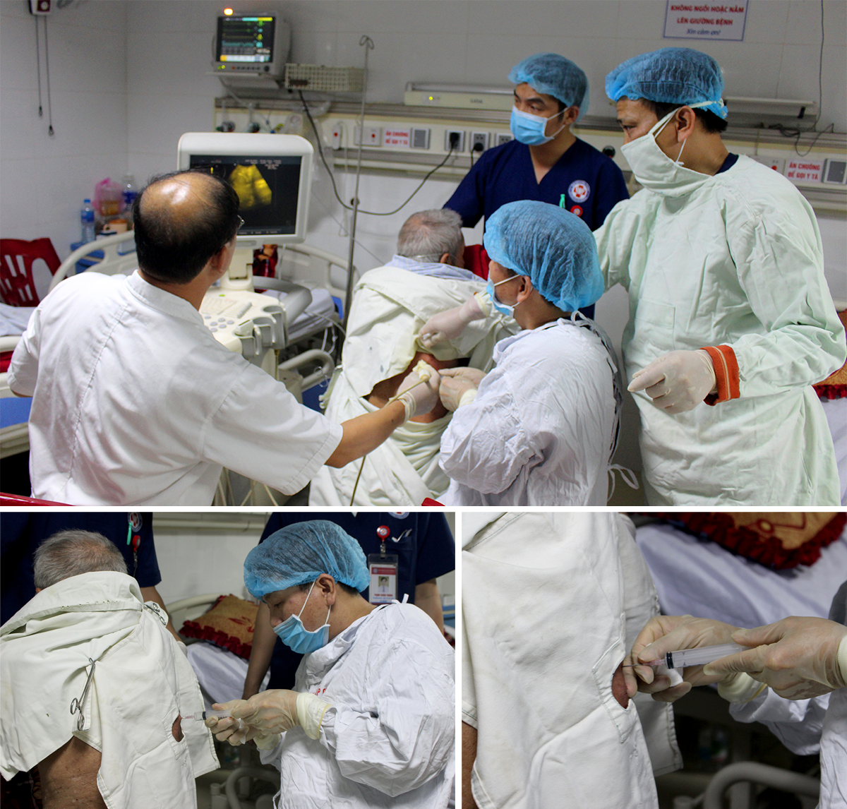 Các bác sĩ Bệnh viện Đa khoa Cửa Đông đã thực hiện kỹ thuật chọc hút màng phổi cho bệnh nhân Nguyễn Khắc Nam. 