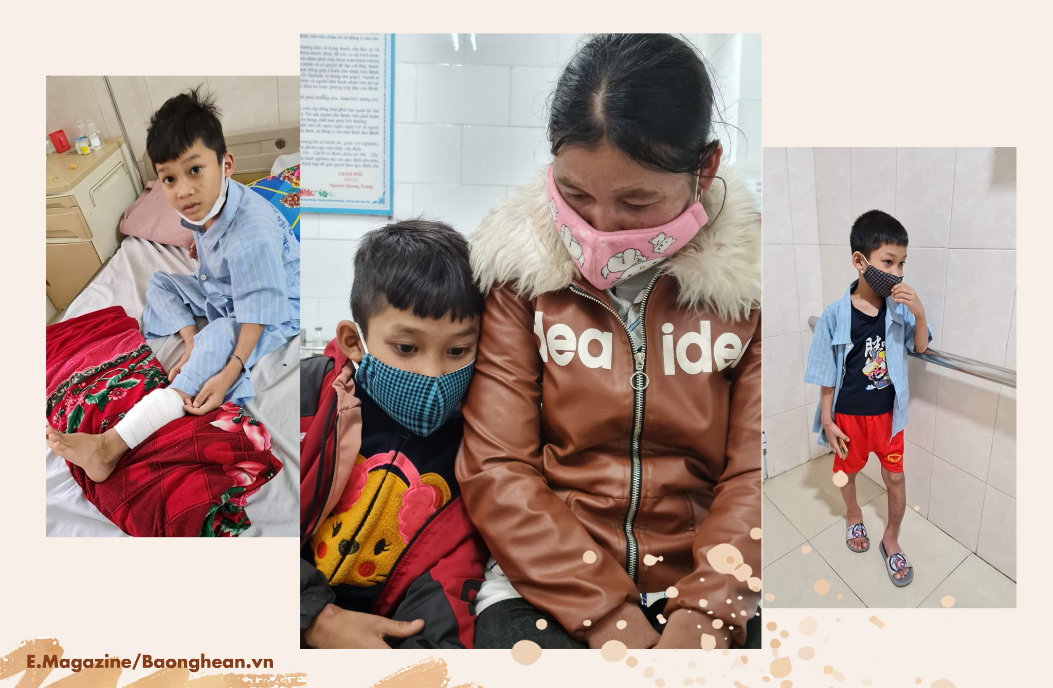 Em Cụt Văn Lu điều trị chân tại bệnh viện; Hai mẹ con Cụt Văn Lu tại bệnh viện; Những ngày ở viện em Cụt Văn Lu luôn mong chân nhanh khỏi để được về đi học.