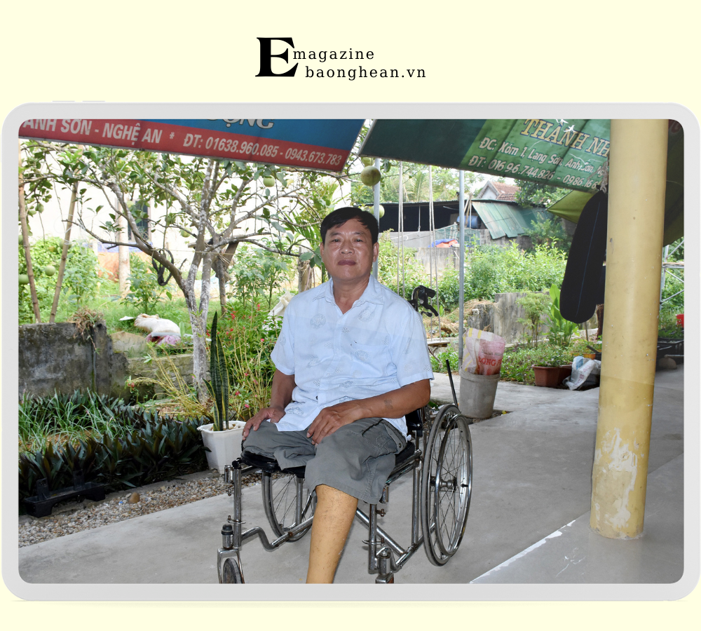 Thương binh Nguyễn Hồng Yên bị mất đôi chân, mất 91% sức khỏe. Ảnh: Công Kiên