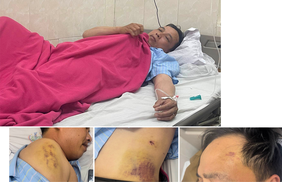 Anh Nguyễn Khắc Hoàn tại Bệnh viện Chấn thương chỉnh hình Nghệ An và những vết thương trên cơ thể.