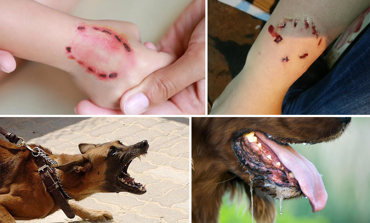 Một số hình ảnh bị chó cắn và biểu hiện của bệnh dại ở chó. Ảnh: Tư liệu